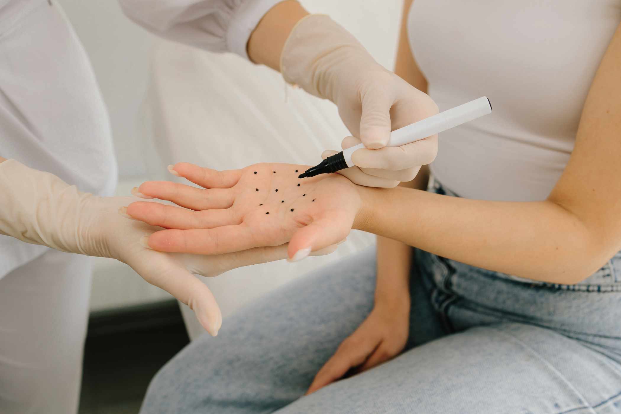 marking-dots-on-palm-for-filler-injection-to-treat-JGKPC3Y.jpg